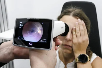 Nové vyšetrenie v optikách: AI odhalí zmeny za pár sekúnd